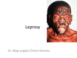 Leprosy - doc meg's hideout