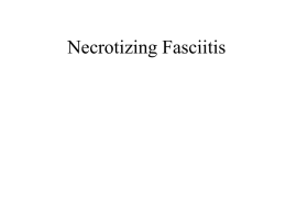 Necrotizing_Fasciitis_Case