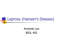 Leprosy (Hansen`s Disease)