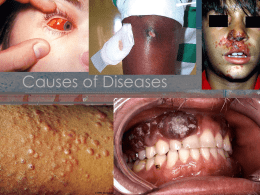 Causes of Diseases