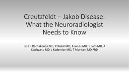 Creutzfield * Jacob Disease: What the