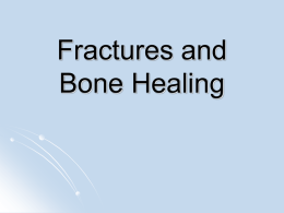 Fractures and bone healing - White Plains Public Schools
