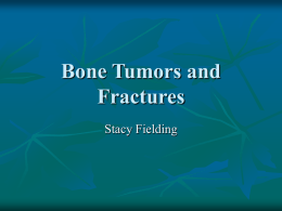 Bone Tumors and Fractures - University of Prince Edward Island
