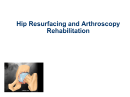 Hip Resurfacing - Elite Physical Medicine