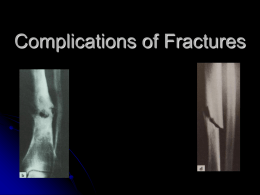 5-6._General_Principles_of_Fracture_