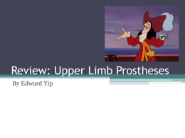 Review: Upper Limb Prostheses