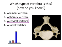 Which type of vertebra is this? (how do you know?)