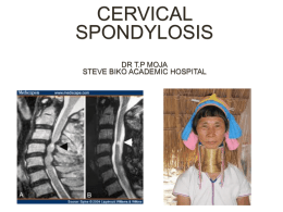 cervical spondylosis dr tp moja steve biko academic hospital