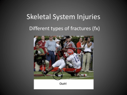 Skeletal Injuries*Fracture