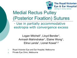 Medial Rectus Pulley (Posterior Fixation) Sutures