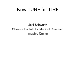 New TURF for TIRF - Stowers Institute for Medical Research
