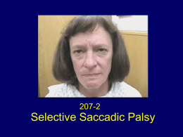 Selective Saccadic Palsy