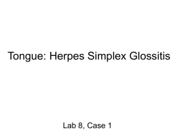 Tongue: Herpes Simplex Glossitis