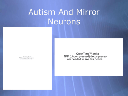 Group 8: Autism and Mirron Neurons
