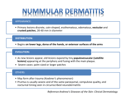 Nummular Dermatitis