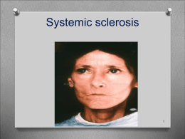 Systemic sclerosis (SSc)