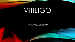 Vitiligo - andoverhighanatomy