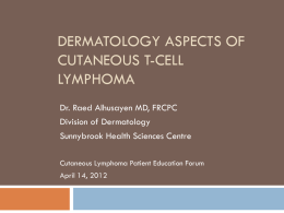 Dermatology Aspects of Cutaneous Lymphomas