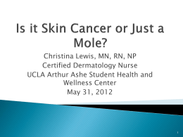 Is it Skin Cancer or Just a Mole?