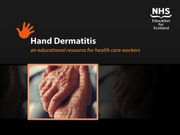 Hand Dermatitis