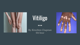 Vitiligo - S3 amazonaws com