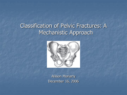 Classification of Pelvic Fractures: A Mechanistic Approach
