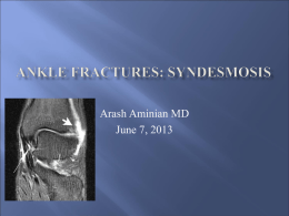 Ankle Fractures: syndesmosis - Orthopedic Surgery | Tustin