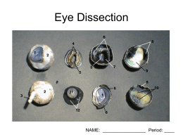 Eye Dissection