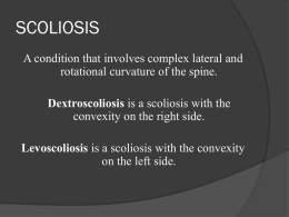 Postural Scoliosis