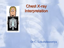 Chest X-ray Interpretation – By Dr. Chandrasiri Lokubalasooriya