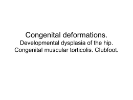 Congenital deformations. Developmental dysplasia of the hip
