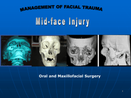 Midface injury