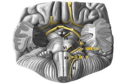 Cranial Nerve VIII