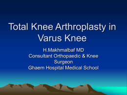 Total Knee Arthroplasty in Varus Knee