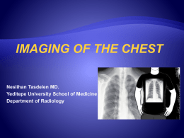 x-ray examination of the lungs - University of Yeditepe Faculty of