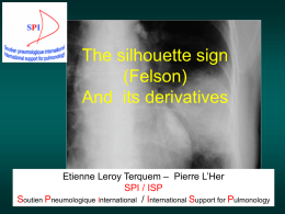 The silhouette sign - International Society of Radiology