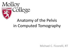 Anatomy of the Pelvis in CT