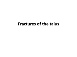 Fractures of the talus