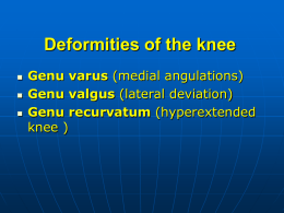 Deformities of the knee