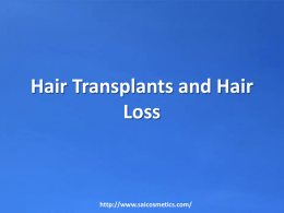 Hair Transplants and Hair Loss
