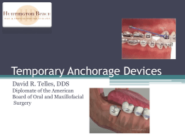 Temporary Anchorage Devices - Huntington Beach Oral and