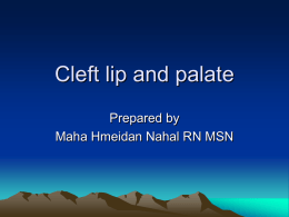 Cleft lip and palate - IMET2000-Pal