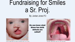 Fundraising for Smiles Powerpoint