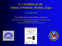 E1 EyeBalls 3D