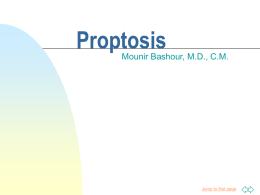 Proptosis
