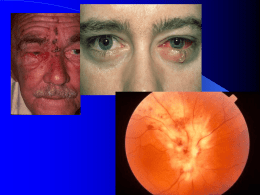 viral eye infections and treatment