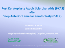 Post Keratoplasty Atopic Sclerokeratitis after Deep Anterior Lamellar