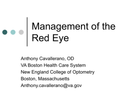 Management of the Red Eye