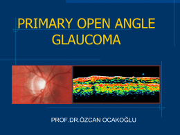 primary open angle glaucoma