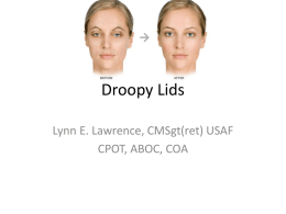Droopy Lids - Lynn`s Lecture Help